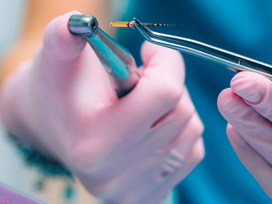 endodontist in liverpool