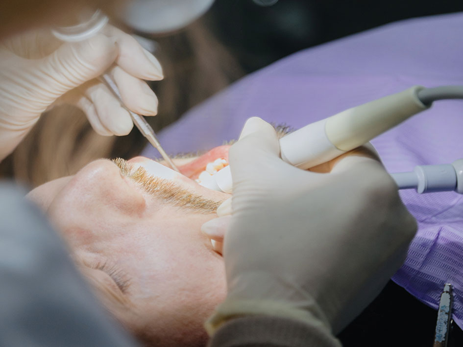 private root canal treatment in liverpool