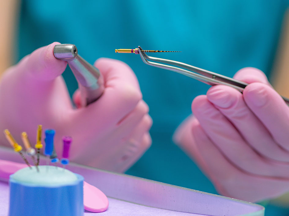 root canal dentist in liverpool